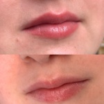 lip blush